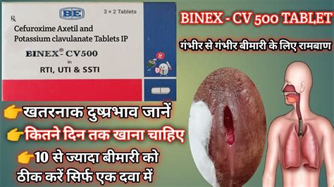 Binex drug & pharmaceuticals. Binex available forms, doses, prices