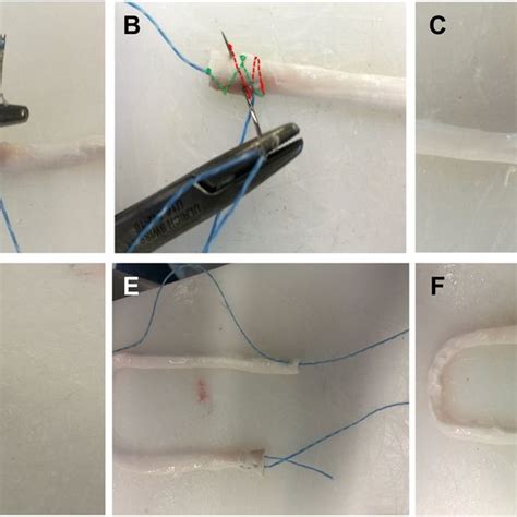 Biomechanical comparison of the use of different surgical suture …