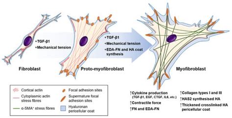 Biomolecules Free Full-Text Myofibroblasts: Function, Formation ...