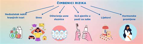 Biorazgradivi konci u ustima. .  <a href=https://doorhan-kupit.ru/bwoxn/epson-su...