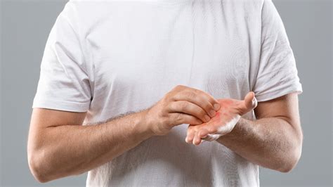 Birçok hastalığın belirtisi! Avuç içi kaşıntısının en.