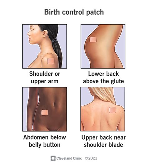 Birth control patch when is it effective