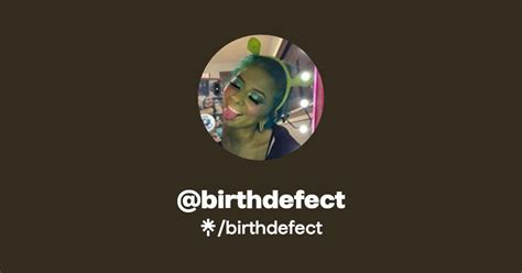 Birth defect leaked onlyfans