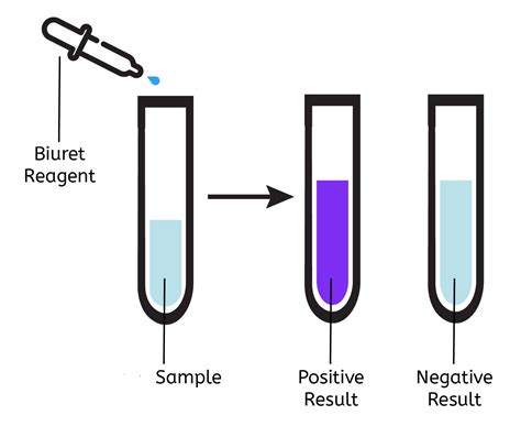 Biuret test-Principle, Requirements, Reagents, Preparation, …