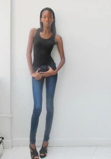 Black anorexic. They think you need to be a certain weight to “qualify” as anorexic, so people of color are too often undiagnosed, misdiagnosed, and mistreated. In order to create a level of comfort for people of color in the eating disorder arena, we need to work on not denying Black peoples’ experience with dismissive comments such as “You don’t look … 