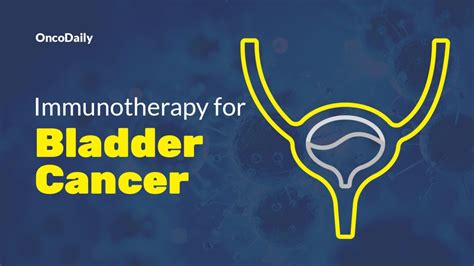 Bladder Cancer Immunotherapy Types Effectiveness and More