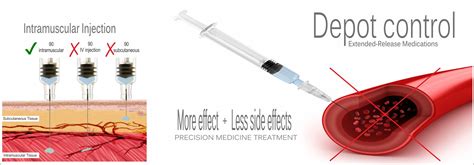 Bleeding after intramuscular injection. Jul 14, 2023 ... Out of all possible outcomes, the only ones we were able to report are pain, bleeding, hematoma and SAT that indicates, potentially, an ... 
