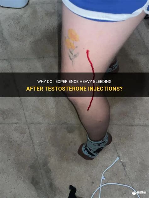 Bleeding after testosterone shot.  Bleeding stopped almost instaneously a...
