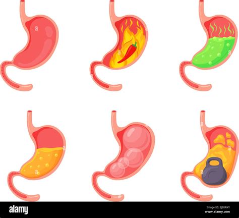 Bloating when stomach is empty