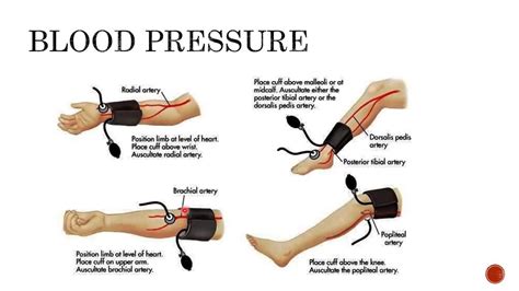 Blood Pressure: Auscultation of Lower Extremity (Ambulatory)