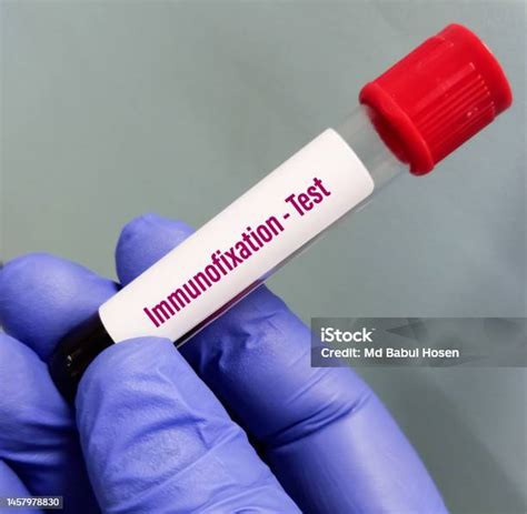 Blood Sample For Immunofixation Test To Help Diagnose Or Monitor