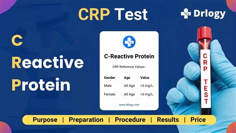 Blood Test: C-Reactive Protein (CRP) - Johns Hopkins All Children…