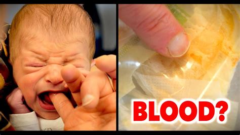 Blood in baby girls diaper — The Bump