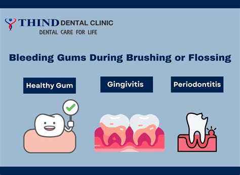 Blood in gums when brushing