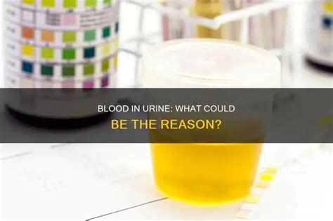 Blood in urine and when i wipe