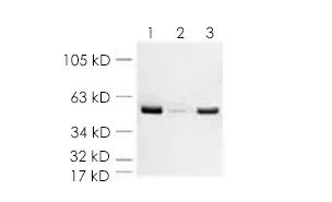 Blue native electrophoresis protocol Abcam / Western blotting …