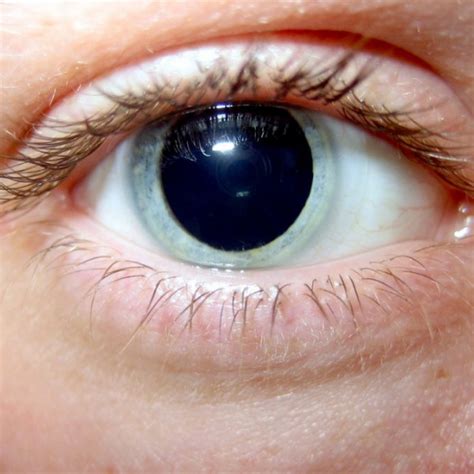 Blurred vision, Enlarged (dilated) pupils, Itching or …