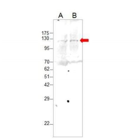 BoNT-A Light Chain Antibody (503013) (MAB4489): Novus …