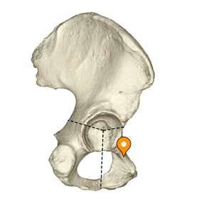 Body of pubis - e-Anatomy - IMAIOS