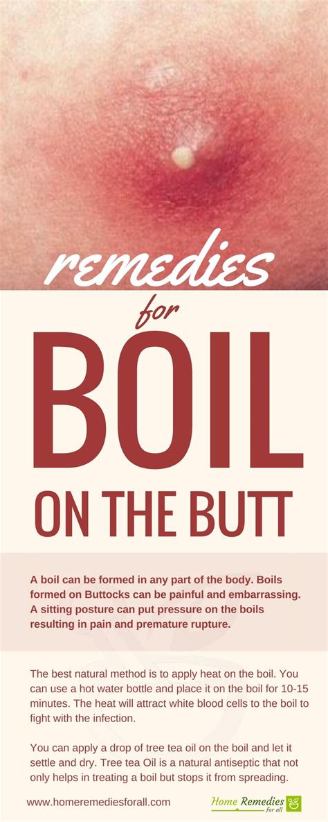 Boil popping on buttocks. Warm compress One of the most common and effective ways to get rid of an inflamed butt boil is to apply a warm compress. Dr. John Cunha on eMedicineHealth recommends applying a warm damp compress to help drain the boil and speed up the healing process. 4 The warm compress helps to improve blood circulation to the infected lump on your buttocks. 
