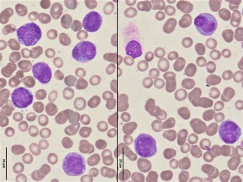 Bone Marrow Culture - an overview ScienceDirect Topics