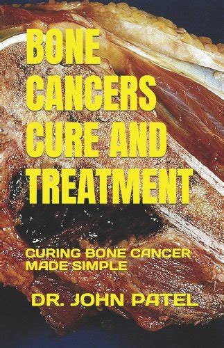Bone cancer cancer cures in detail book 5. - Mercury mercruiser marine 3 7l 4 cylinder number 8 manual.