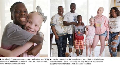 Born Differently Makes a Difference: