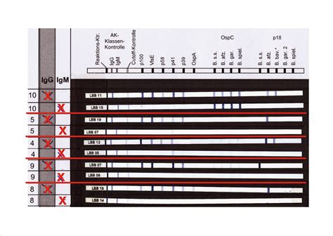 Borrelien-Ak - Labortests - Bioscientia