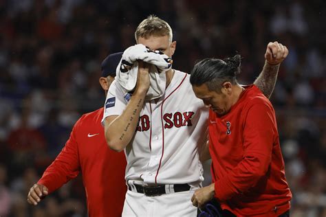 Boston’s Houck hit on face by liner off bat of Yankees’ Higashioka
