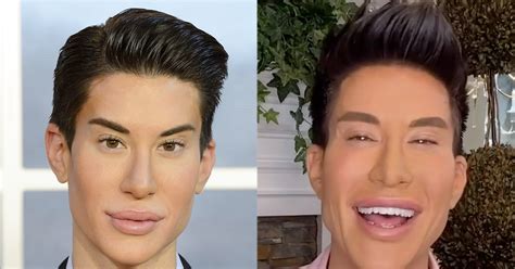 Botched: Human Ken Doll Is Back! Hear About His 900+ Surgeries - E! Online