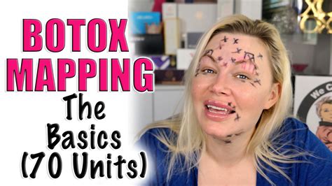 Botox basics Life