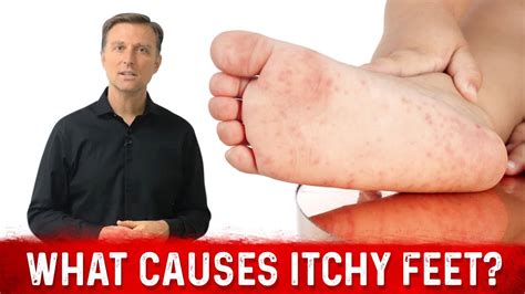 Many things can cause itchy feet. And the fix could be simple or complicated. Some of the reasons could be dry skin, an allergic reaction, an underlying condition, or a change in your medications. But, sometimes the cause is not so obvious. So, why do your feet itch at night? Causes of itchy feet. When your skin is itchy it is called pruritus.. 