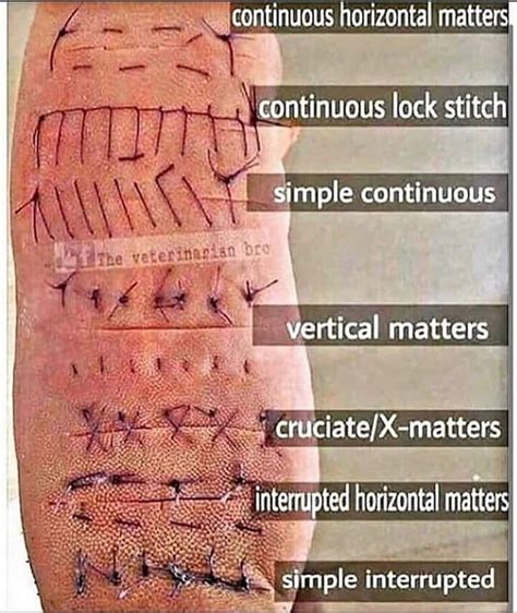 Bottom of foot stitches. Active forums about languages and translation Active ...