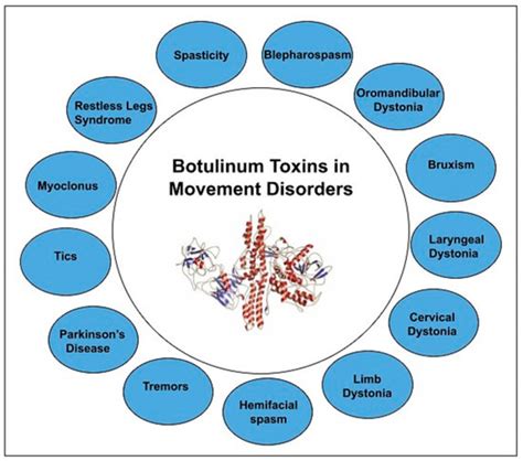 Botulinum Toxin in Movement Disorders: An Update - PubMed