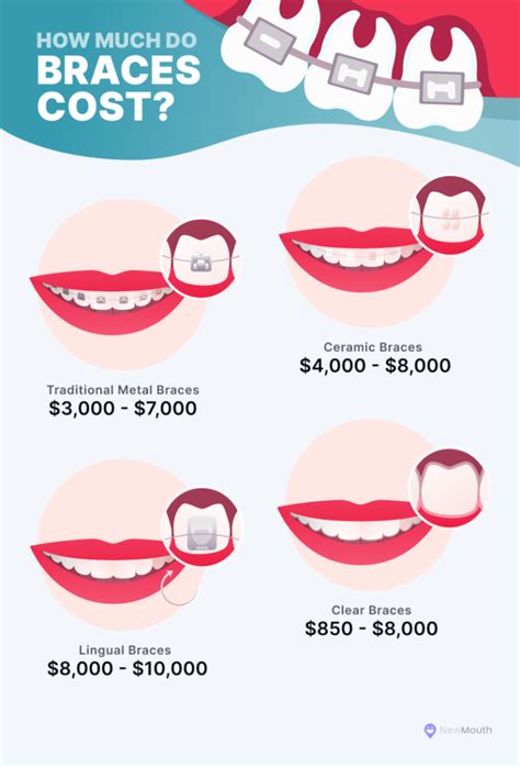 Braces payment plan. Calculate Estimated Monthly Payment or Total Cost. *Please note, this calculator is provided only as a simple tool to estimate what your payments could be. The final cost of treatment and payment terms are dependent on case complexity and determined on an individual basis, and will be confirmed prior to beginning your … 