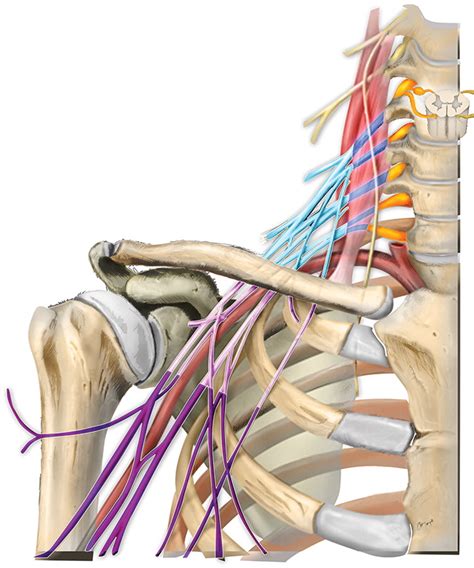 Brachial plexopathy: a review of traumatic and …