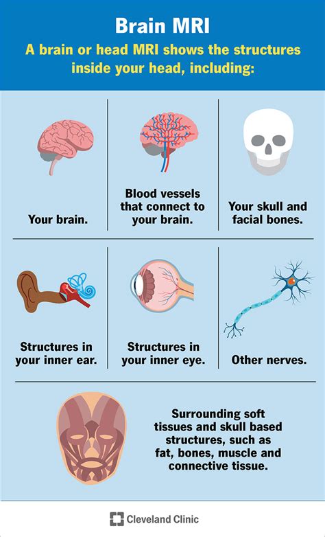 Brain MRI: What It Is, Purpose, Procedure & Results - Cleveland …