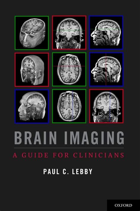 Brain imaging a guide for clinicians. - Lincoln welder manual a 250 g9 pro.