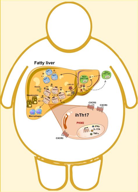 Break Obesity-driven Liver Damage With Targeted Therapy