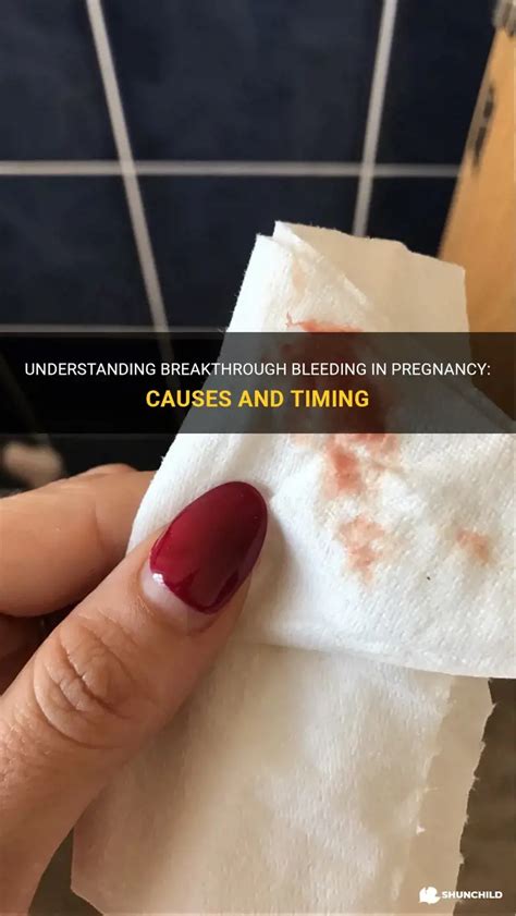 Breakthrough bleeding symptoms.  It was light at first, barely noticeable, but as...