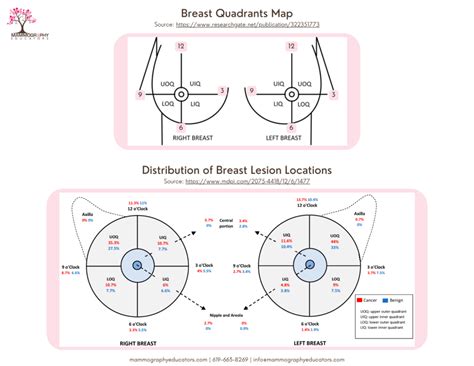 Breast quadrants: how to determine, features - I Live! OK