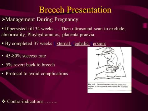 Breech: Types, Risk Factors, Treatment, Complications - Verywell Heal…