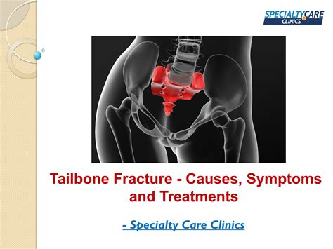 Broken Tailbone or Coccyx Fracture Symptoms Causes …