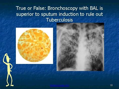 Bronchoscopy with bronchoalveolar lavage causes neutrophil