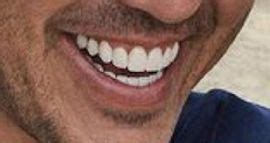 Brooks koepka teeth. Things To Know About Brooks koepka teeth. 