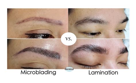 Brow lamination vs microblading. Brow lamination vs microblading. Both brow lamination are semi-permanent eyebrow treatments, but they differ in important ways. Primarily, brow lamination is a gentler option that yields more natural looking results, since there are no needles or ink involved. The downside: Brow lamination doesn't have nearly … 