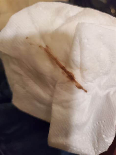Brown stringy discharge. Dark stringy discharge · Hi... · Hello, I've been getting stringy brown discharge every couple of weeks that lasts for a couple of days, it normally comes with&nb... 