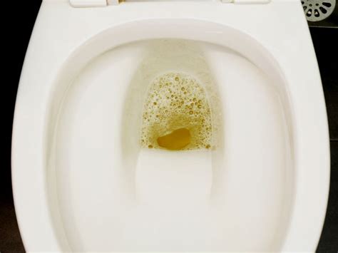 Bubbles in the Urine: Normal or Not? New Health Advisor