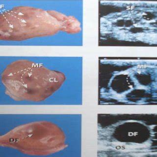 Buffalo Ultrasound - Overview, News & Competitors