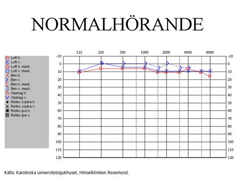 Bullerskada audiogram